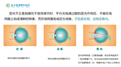 远视怎么治疗？武汉普瑞眼科医院千频优视飞秒手术助远视大学生恢复视力