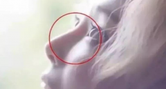 墨卡托鼻整形,满足你对美鼻的需求——  北京彤美李长赋