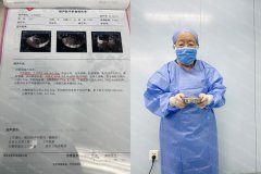 孙爱达教授的“腺肌症保宫术”效果如何?我们用事实说话!